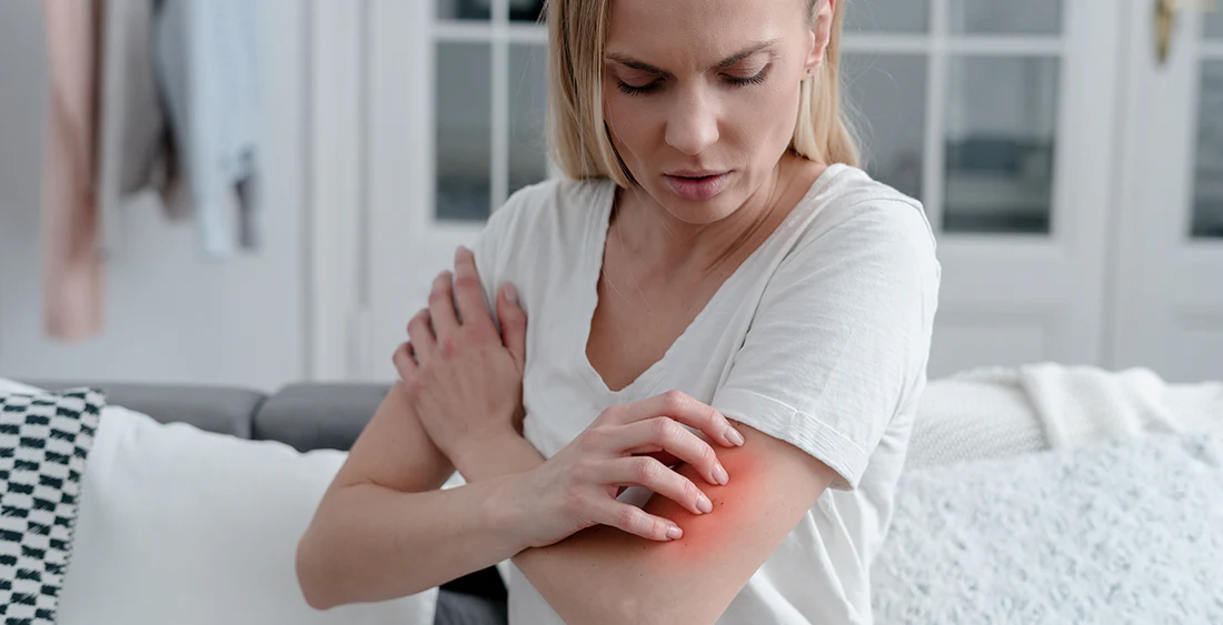 Can Menopause & Perimenopause Cause Skin Rashes